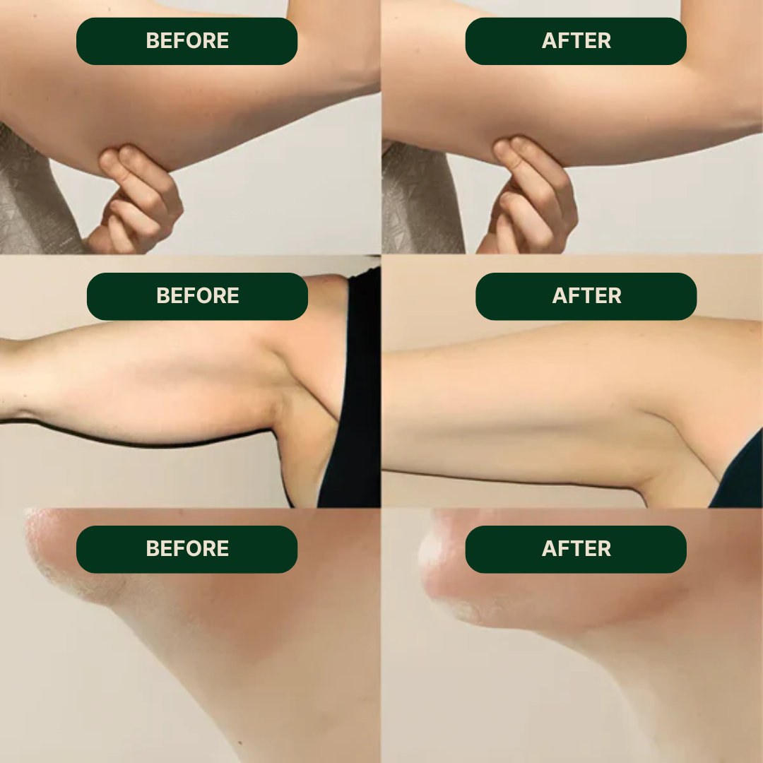 Debloater Lymphatic Drainage